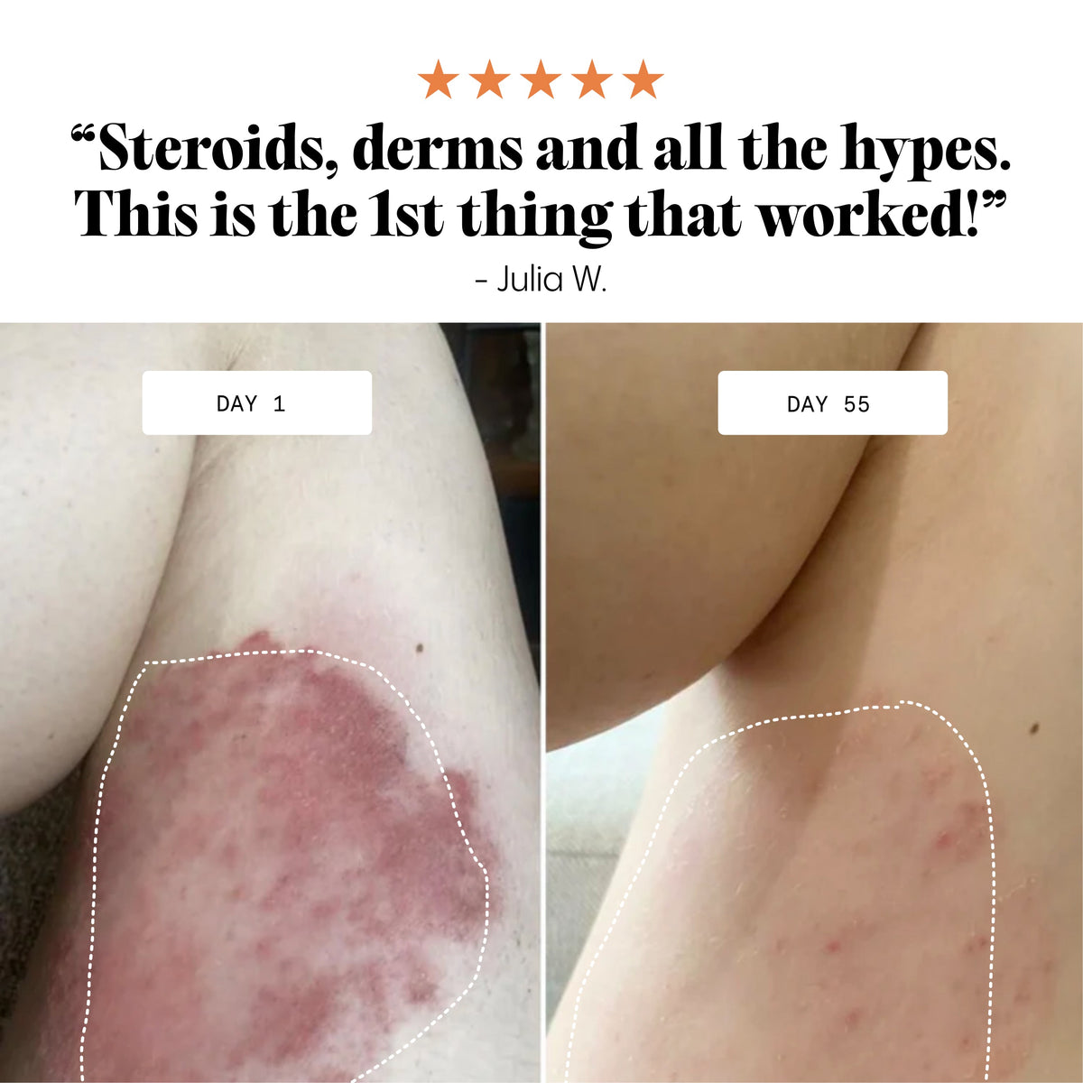 Dry and Itchy Balm for Face and Body