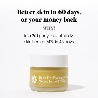 Dry and Itchy Balm for Face and Body