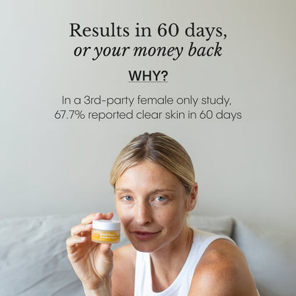 The Complete System for Acne-Prone Skin